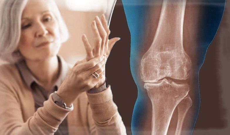 ��� ������������ �������� ������ ����� 55: ������ � ��������������