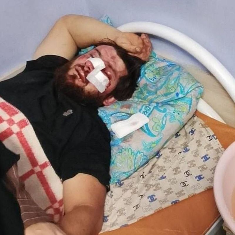 В Хасавюртовском районе четверых братьев избили кастетами и битами В Хасавюртовском районе четверых братьев избили кастетами и битами