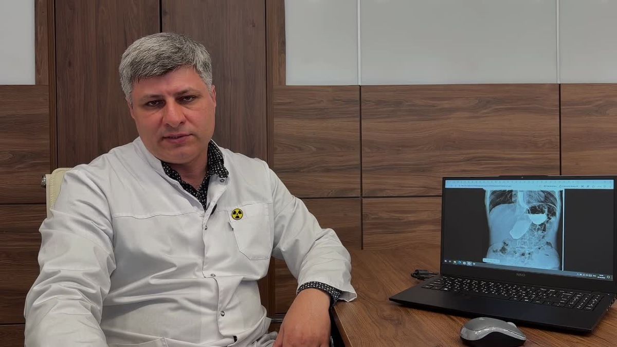 Как определить степень загиба желудка и почему это важно для диагностики?
